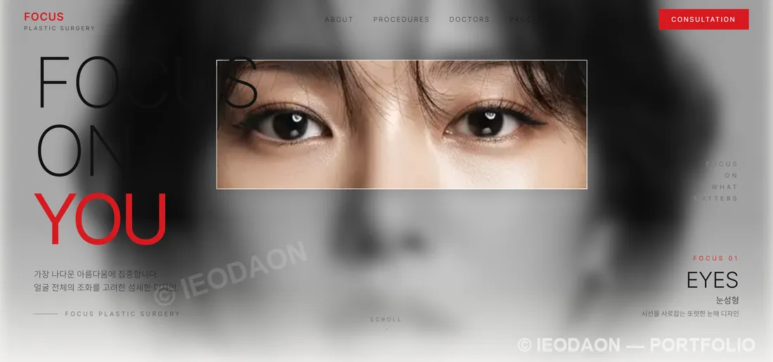 FOCUS 성형외과 웹사이트 — 흐린 얼굴에서 눈 부위만 선명하게 포커스된 히어로 화면
